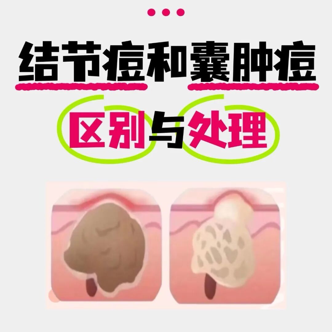 战 “痘” 全攻略|从成因到解决,科学护肤不踩坑
