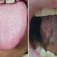 桂枝茯苓丸：应对寒凝血瘀的温和调理方案