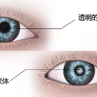 别被“护眼神药”忽悠了！叶黄素真正起效的4个关键维度，90%的人买错却毫无察觉