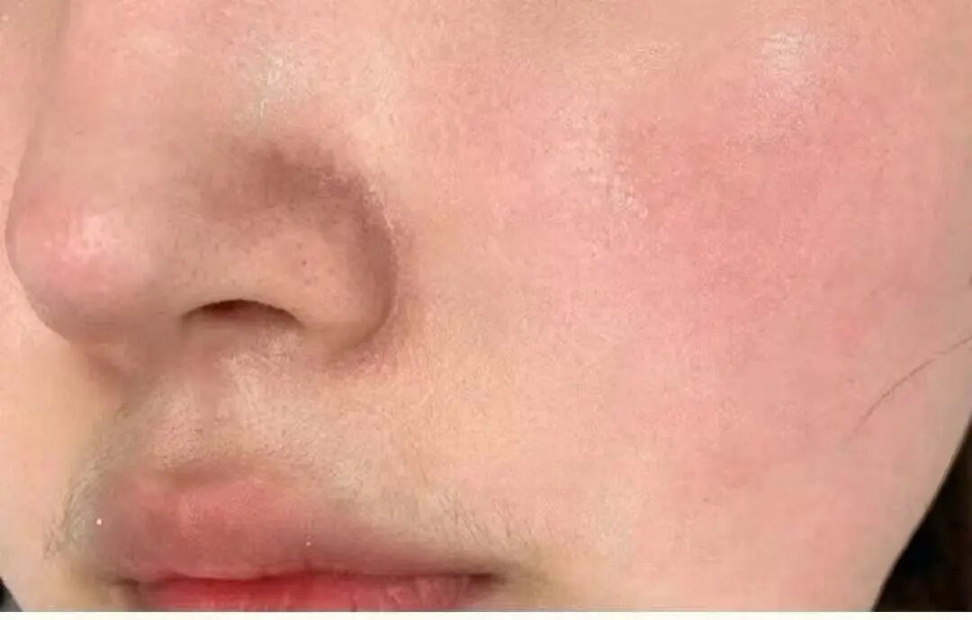 护肤不对等于毁容?千万别踩这些冬季护肤大忌!