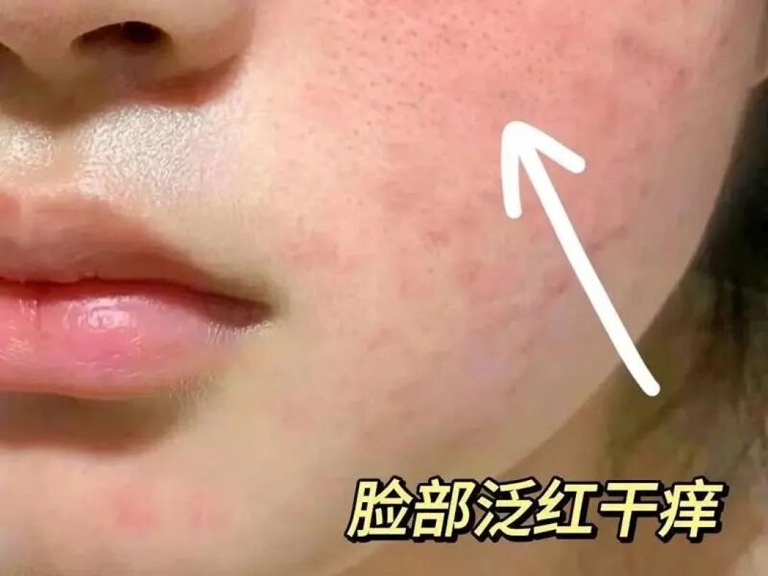 难怪别人春节皮肤状态不翻车!节前突击维稳的秘密,终于藏不住了