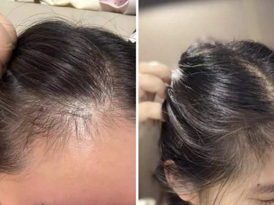 控油生发育发防脱发洗发水推荐!10 款油头专属防脱洗发水排行榜实测!