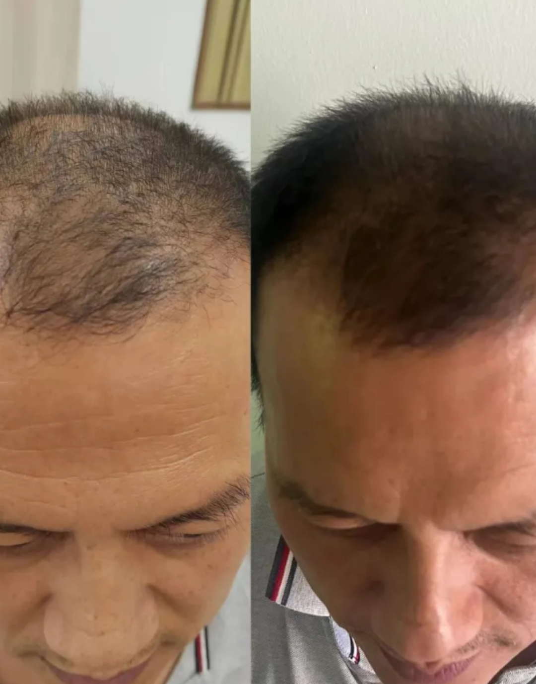 控油生发育发防脱发洗发水推荐!10 款油头专属防脱洗发水排行榜实测!