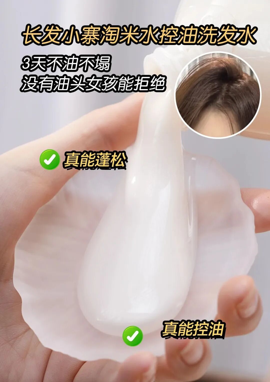 别再乱用偏方了！秃头脱发应该这样做