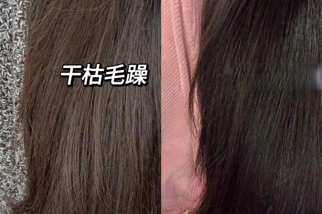 别再乱用偏方了！秃头脱发应该这样做