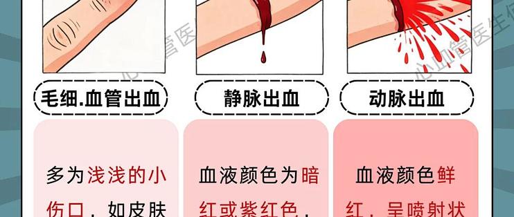 伤口不同类型出血怎么处理?家庭急救必看_安全健康_什么值得买