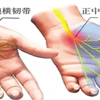鼠标手自救指南：2-4周缓解手麻酸痛，重获灵活双手