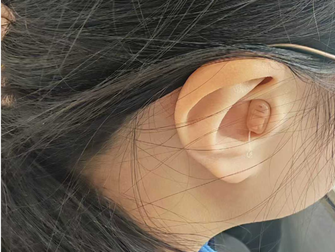 助听器戴久了感觉声音变小了？别慌，6个常见原因逐一排查！