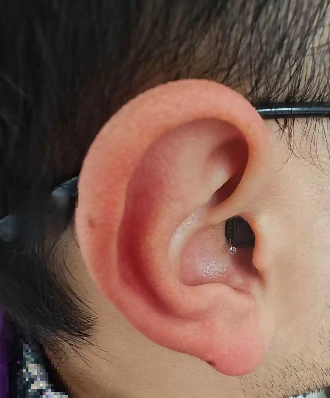 助听器戴久了感觉声音变小了？别慌，6个常见原因逐一排查！