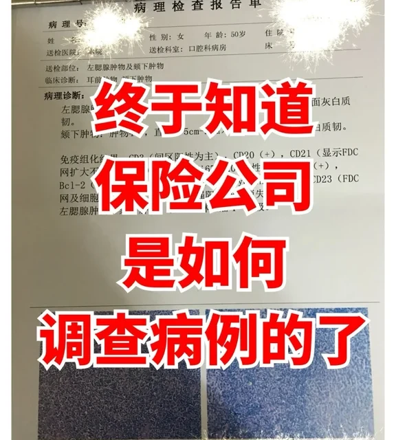 内部爆料！你猜保险公司是咋查到你病史？