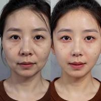 35+抗老面霜怎么选？国货凭体系化科技和实测数据，300元档干翻千元大牌