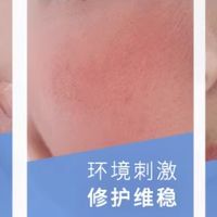 兼顾急护与长效维稳，敏感肌优选急救面霜推荐