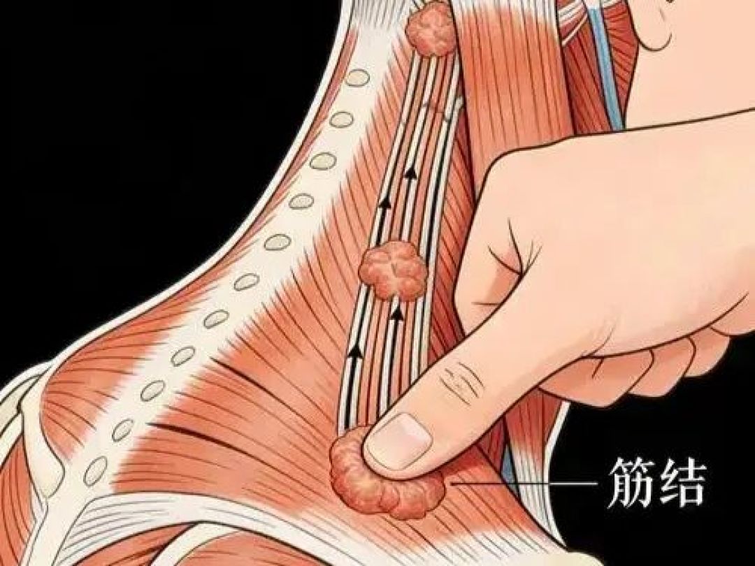 肩颈疼痛居家养护