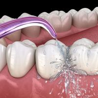 冲牙器是智商税吗？值不值得“冲”？