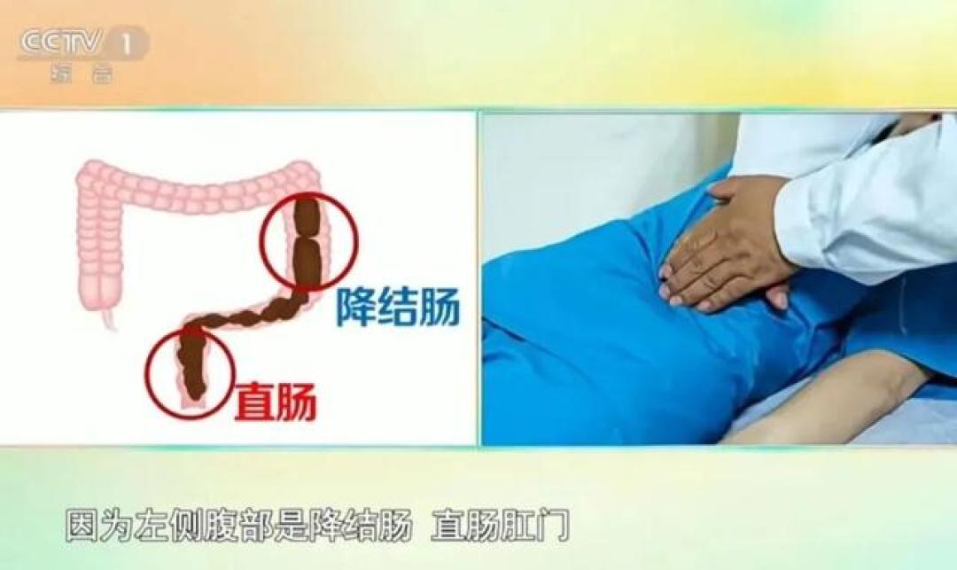 不用吃药,中医5招帮你缓解便秘