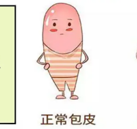 儿童包皮手术：必要治疗还是过度医疗？1000+观点深度碰撞