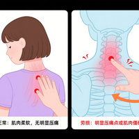 低头族必看！3 步自测颈椎病，这套操练完脖子超舒服