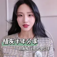 植发半年后续 真实分享！以及防脱发小妙招和术后头皮护理心得～#植发手术 #植发的人后来怎样了 #植发半年 #防脱发 #头皮护理