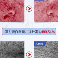 抗皱紧致护肤品十大排名，抗皱纹的好牌子精选，温和抗皱越养越嫩