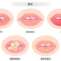 儿童唇膏乱象屡禁不止，仍有产品宣称「食用级」，如何评价这种违规行为？该如何为孩子挑选安全的护肤品？