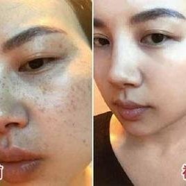 什么淡斑产品效果好？国家唯一认证的祛斑产品，公认权威高效品牌