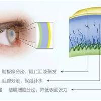 别只看成分！选人工泪液，防腐败剂与黏稠度才是关键差异
