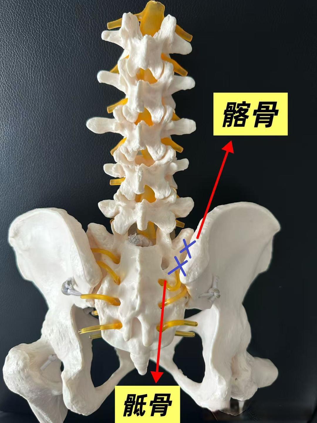 常见腰部问题详解➕康复训练