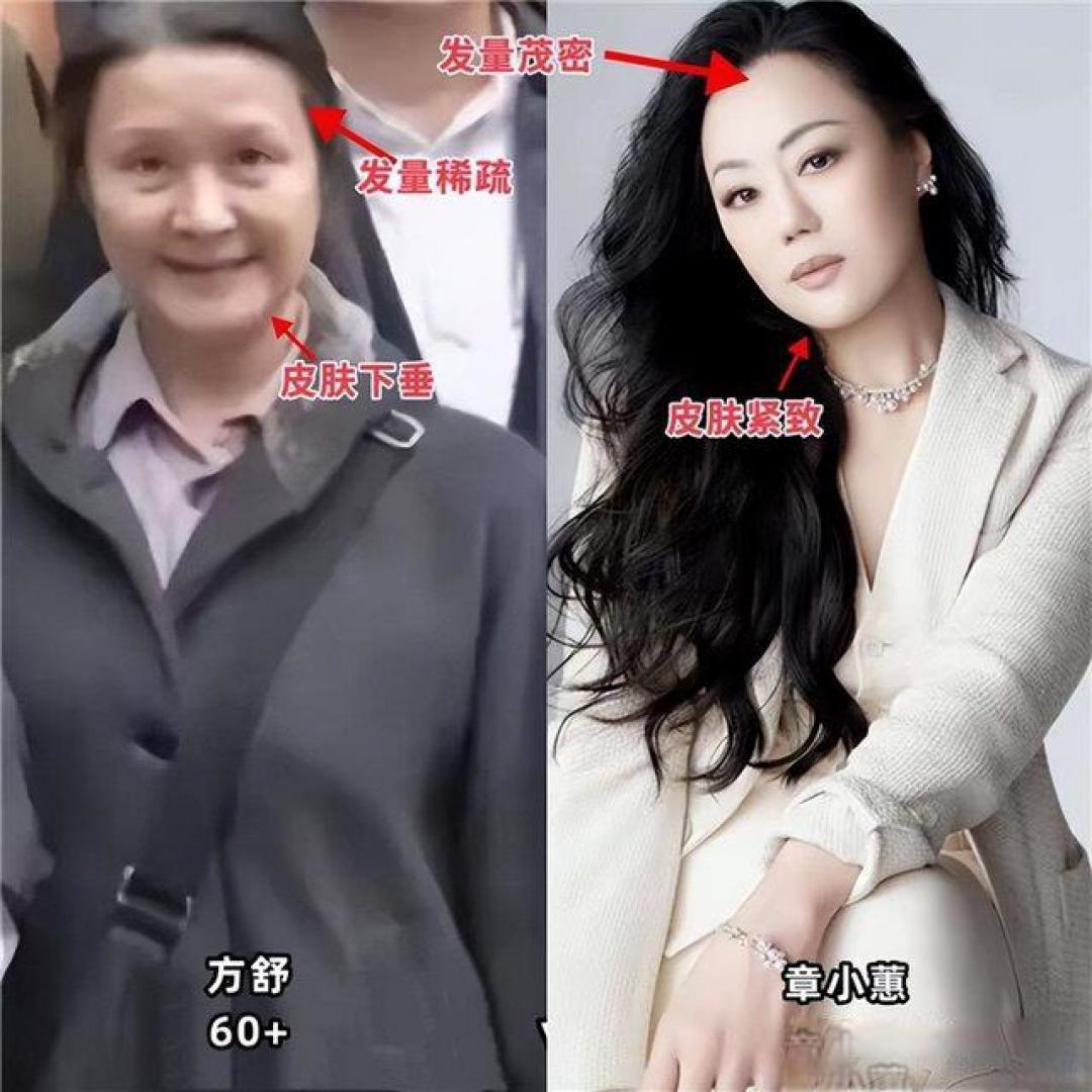 同样62岁,看了何赛飞,再看章小蕙,才懂“老得慢”的人关键在哪