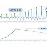 柯氏音法 vs 示波法血压计？128位用户真实体验告诉你答案