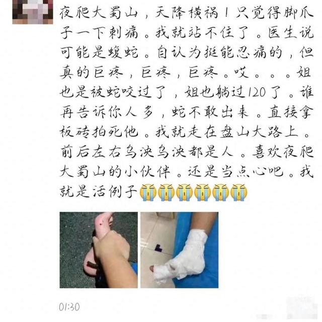 女子夜爬大蜀山被毒蛇咬伤！这种蛇善于伪装，要小心