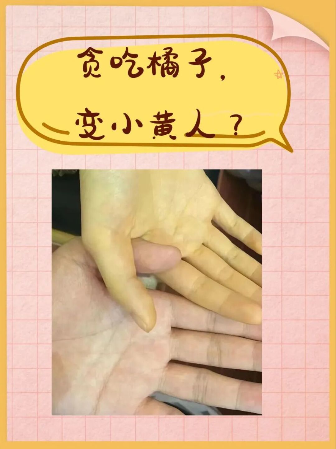 假期狂炫砂糖橘后,咋变成了小黄人!!