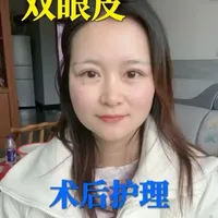 双眼皮术后护理你都做对了嘛？想做双眼皮的姐妹赶紧收藏起来
#记录真实生活 #双眼皮 #变美