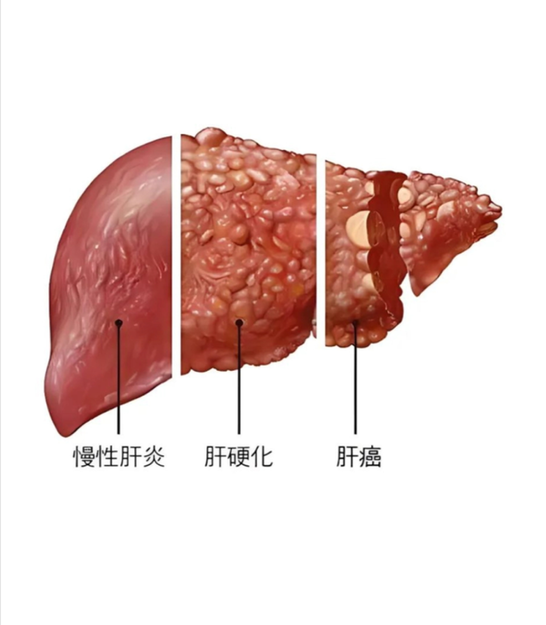 一诊断活不过三个月的老人,被片仔癀治愈?片仔癀到底有什么功效