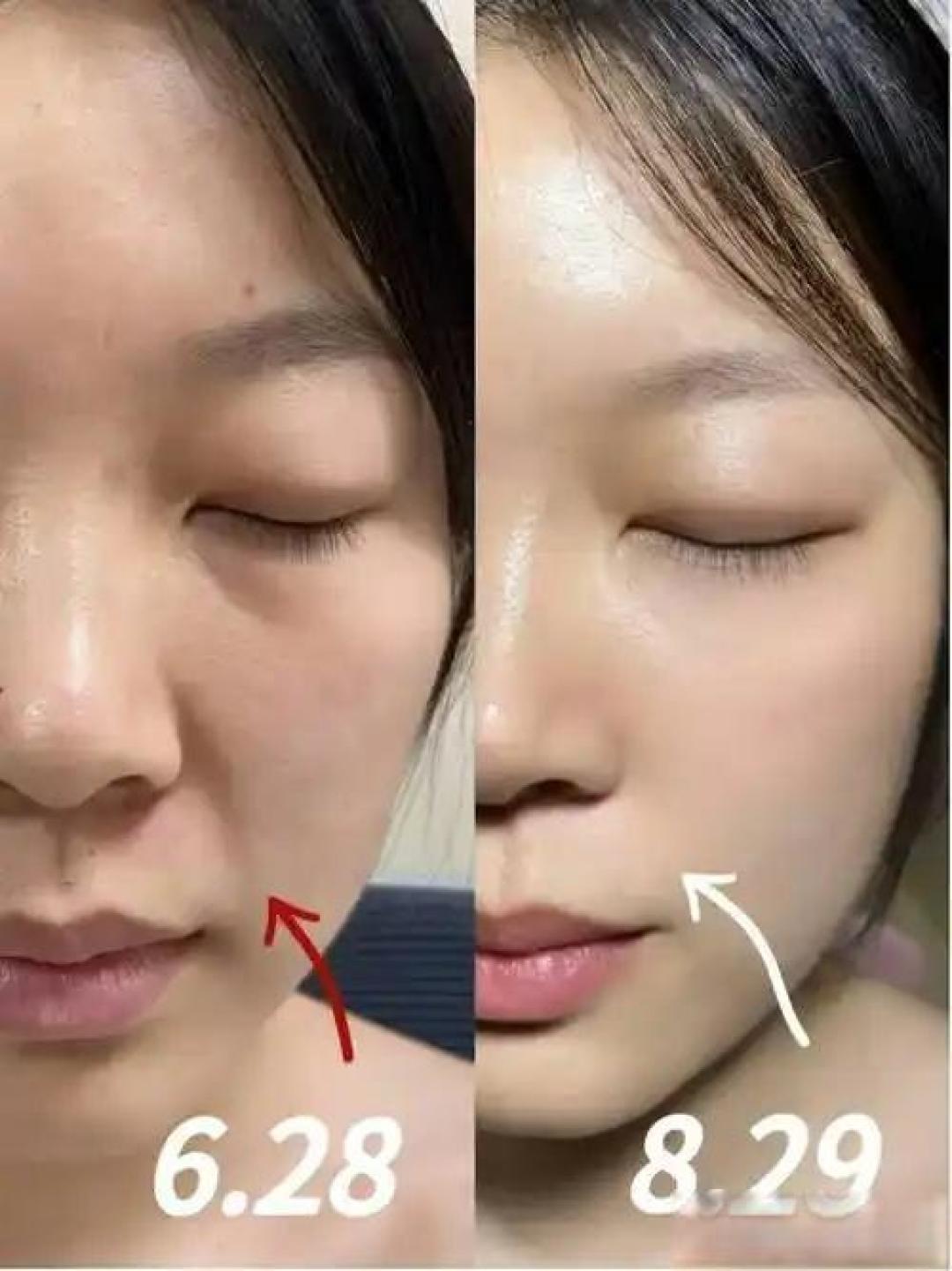 可以推荐一款乳液或面霜吗?