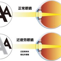 “老视”更名 | 别再让一个名字，挡住你享受清晰世界的权利