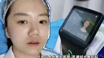 三甲医生Do脸vlog｜黄金微针到底疼不疼？替你们试过了！ 
作为每天给别人做医美项目的医生，我自己也会定期做皮肤管理～
🔍 为什么选黄金微针？
黄金微针是 “微针 + 射频” 的组合，通过微针刺破皮肤，同时射频能量刺激真皮层胶原再生，既能改善毛孔、细纹，又能紧致皮肤。
#八大处刘温悦 #黄金微针 #医美 #过年 #过年套装