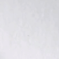 牙齿美白小技巧，让你轻松拥有自信笑容