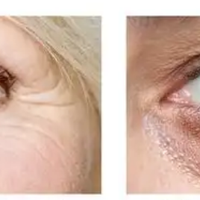 2026年眼部精华油品牌TOP5排行榜，专业实测精选品牌