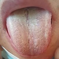 舌苔黄腻别乱补！7天分步调理法，清湿热补阴虚从根上解决