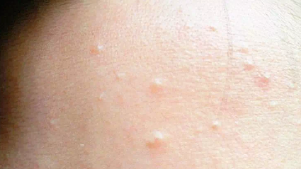 卸妆油不致痘的关键：乳化速度与植物油脂选择比清洁力更重要