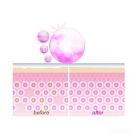 植物A醇更适合敏感肌，传统A醇见效快但门槛高