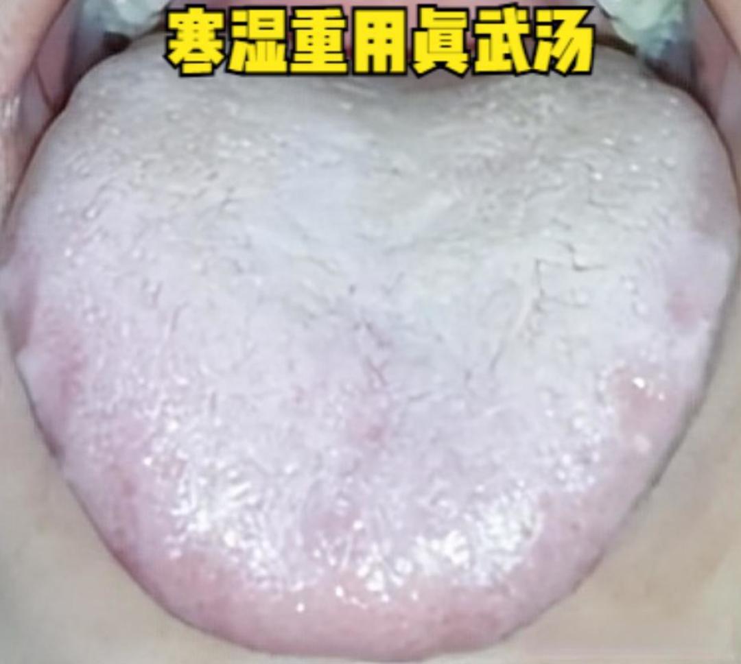 辨别痰湿、寒湿、湿热,对症调理是关键