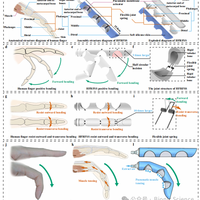 文献荐读 | Nature Communications: 刚-柔-软耦合的仿人手指结构