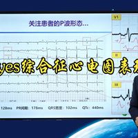 97.bayes综合征心电图表现（下壁导联P波正负双相）