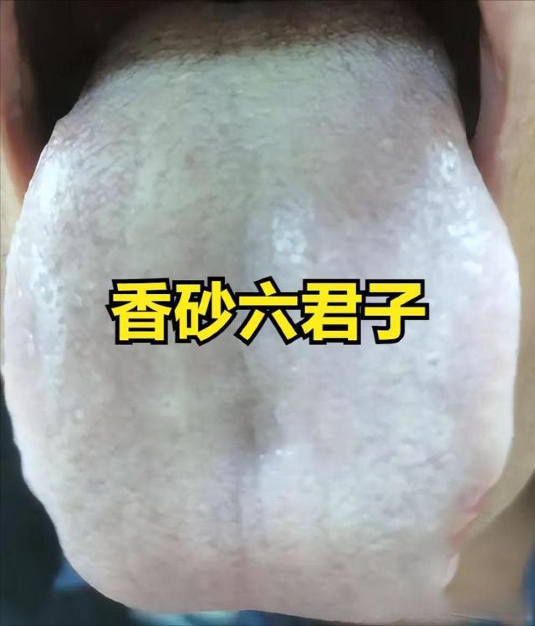 齿痕舌湿气重分两种 一种要 祛湿 一种要 化痰 对症调理才能事半功倍