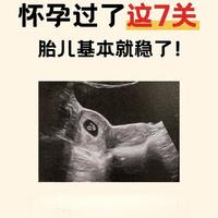 孕期稳稳过关：抓住这7个关键阶段，孕妈安心、胎儿更稳妥