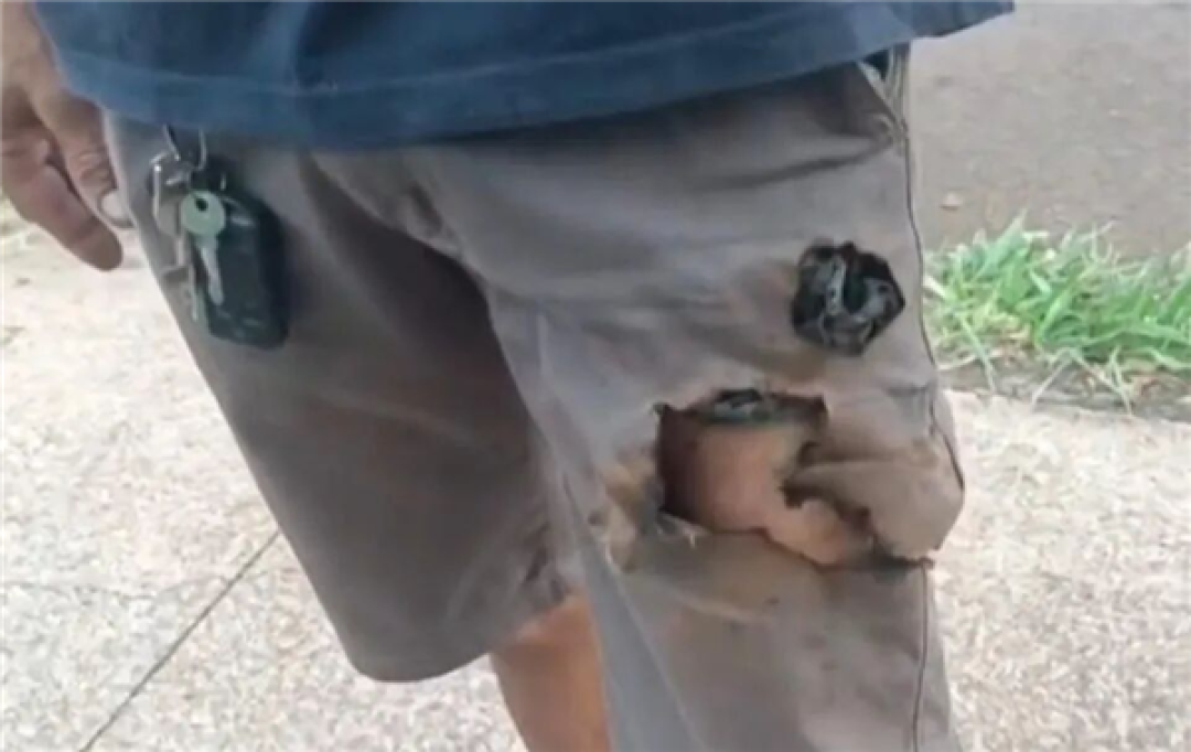 巴西男子被两条狗狂咬 手机突然爆炸救了他一命