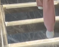 下楼看手机踩空了，脚踝肿成馒头，以为要歇一周，结果