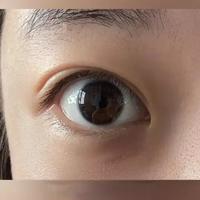干眼护理|千眼好转就是把眼部护理融入日常干眼不是一朝一夕形成的，自然也不可能有神药短时间快速好转，当把干眼护理融入日常，时刻关注眼睛感受，才是好转治愈的开始欢迎分享你觉得有用的干眼护理～#干眼症 #脸板腺堵塞 #健康用眼生活 #护眼 #干眼