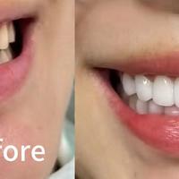 新手入门电动牙刷选哪个好？